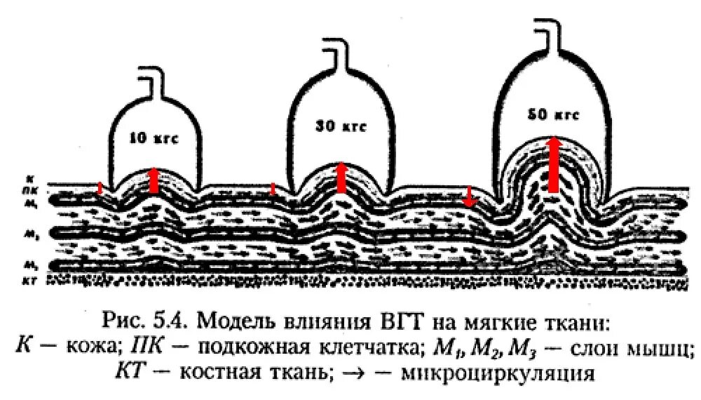 Действие банок. Механизм действия вакуумного массажа. Вакуумный массаж принцип действия. Вакуумный массаж схема действия.