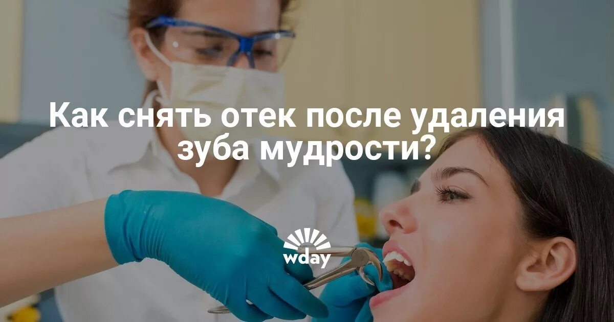 Сколько держится отек после удаления мудрости. После удаления зуба мудрости. припухлость после удаления зуба мудрости. оттек после удаления зуба мудрости. отек после удаления мудрого зуба.