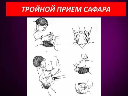 Прием сафара