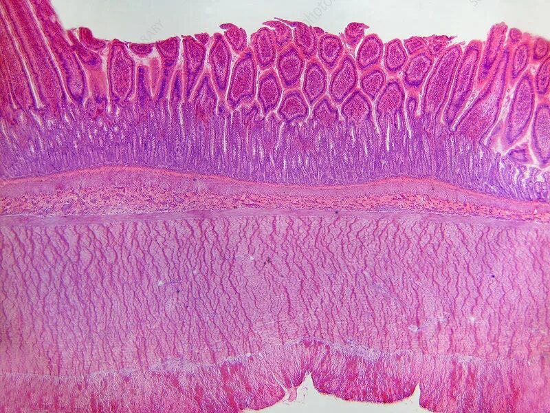 Регенерации слизистой оболочки. Кишечная Ворсинка гистология. Эпителий желудка гистология. Оболочки толстой кишки гистология. Эпителий слизистой Толстого кишечника.