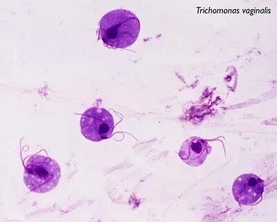 Trichomonas vaginālis