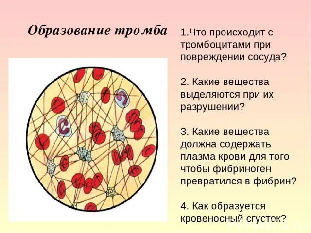 При повреждении сосудов тромбоциты. Схема образования тромба. Образование тромба при повреждении сосуда. Образование кровяного сгустка. Процесс образования тромба.