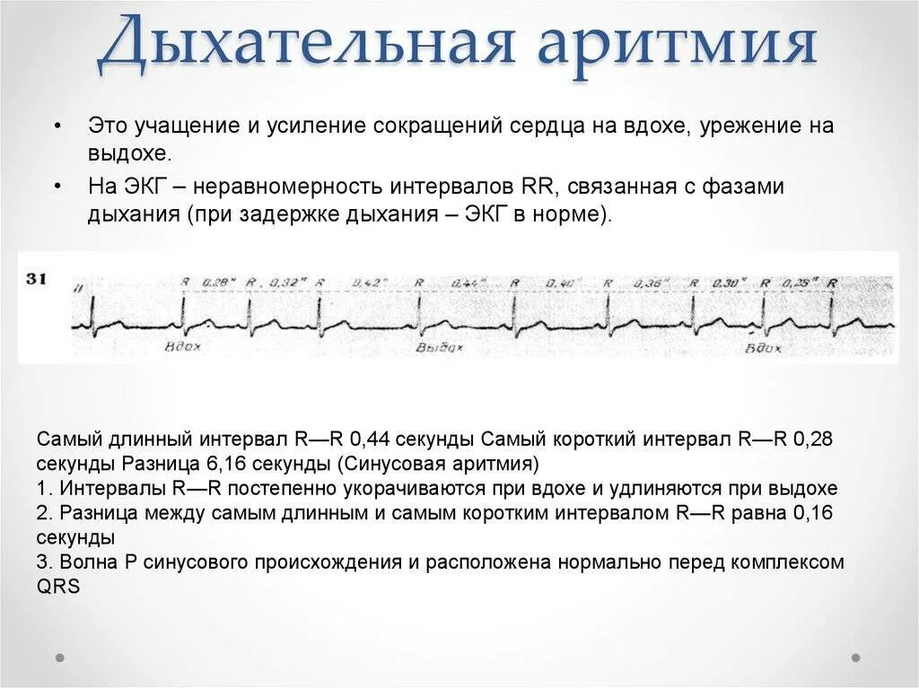 Тахикардия у ребенка 10 лет