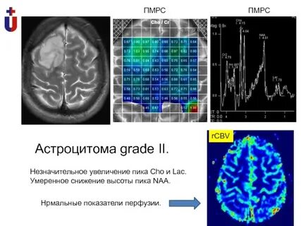 Незначительное увеличение