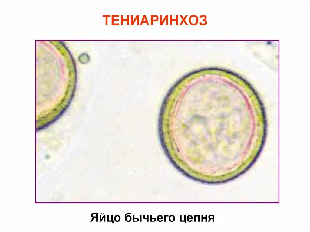 Карликовый цепень микроскопия. Свиной цепень микроскопия. Яйца гельминтов бычьего цепня. Яйца бычьего цепня микроскопия. Яйцо с онкосферой