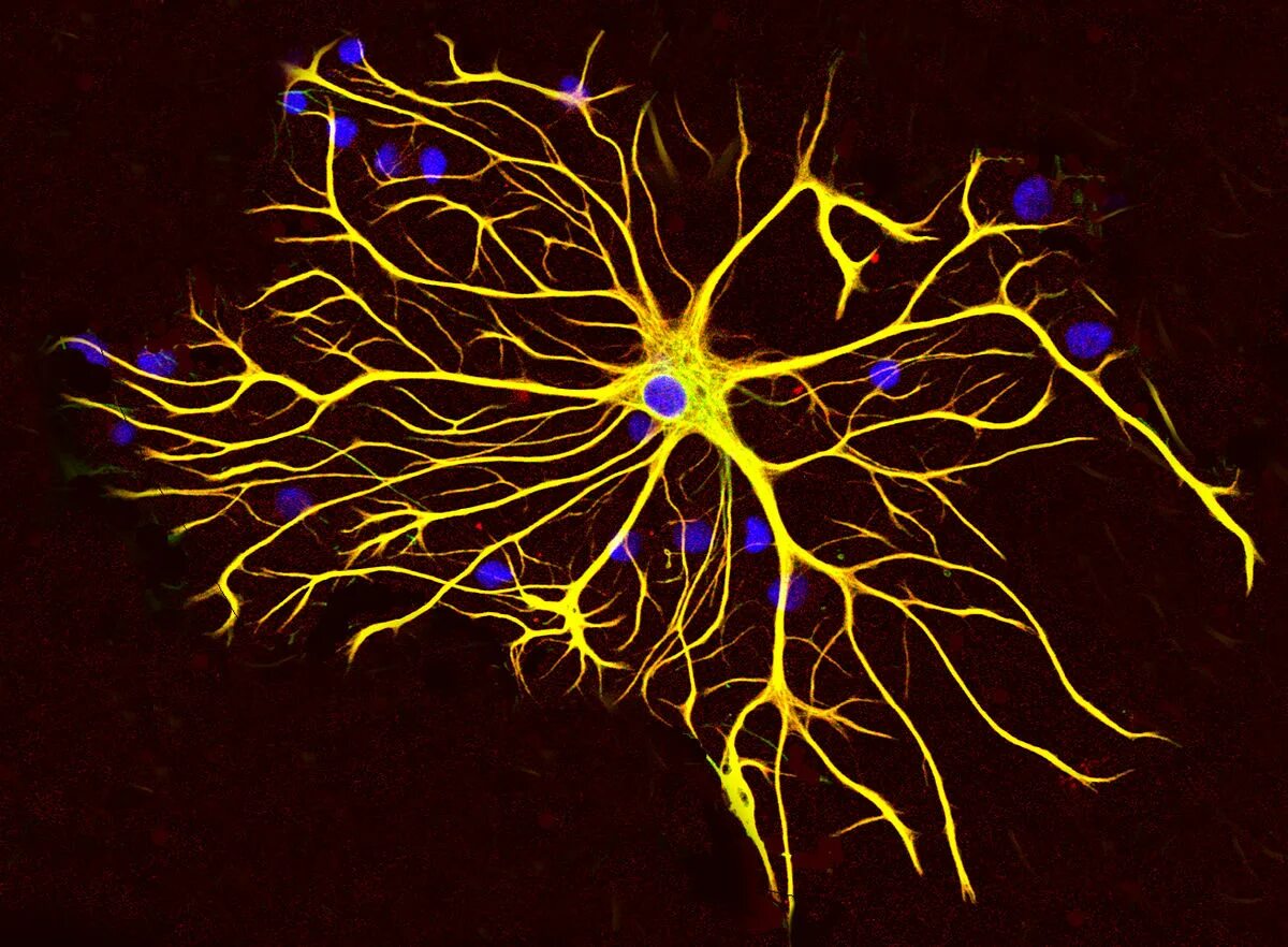 Мозг человека состоит из нейронов. Нервные клетки и глиальные клетки. Астроциты глиальный. Нервная клетка и глия. Нервная ткань Нейроны и глиальные клетки.