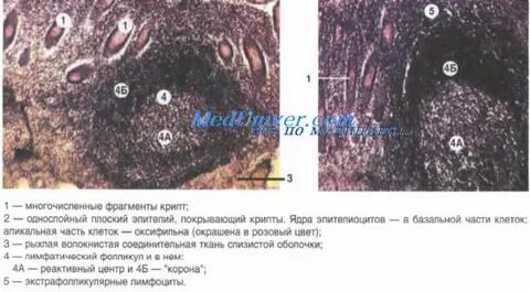 Лимфоидные фолликулы что это