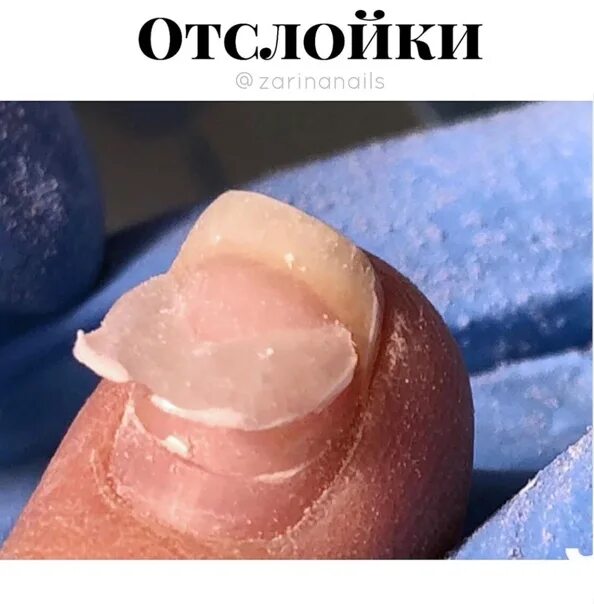 Отслойка гель лака от ногтя. Почему ногти снимаются пленкой