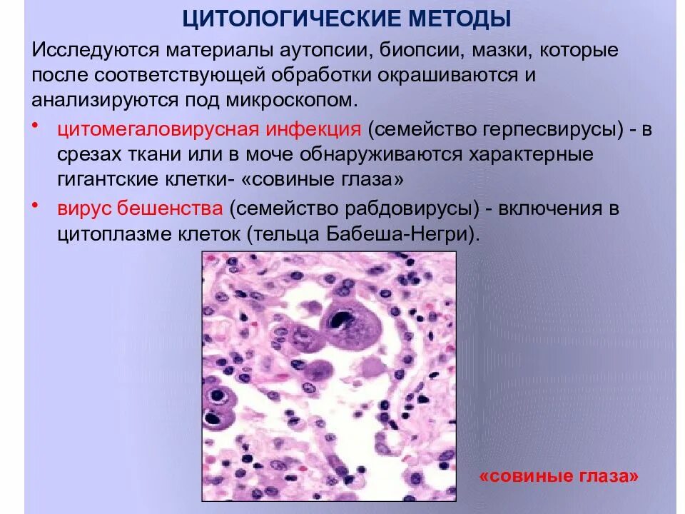 Цитологические и гистологические исследования. Цитологический метод. Цитологический метод исследования. Цитологическое исследование вирусов. Цитологическое диагностическое исследование что это.