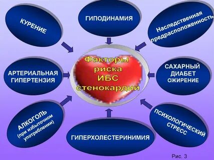 Гиподинамия относится к факторам риска