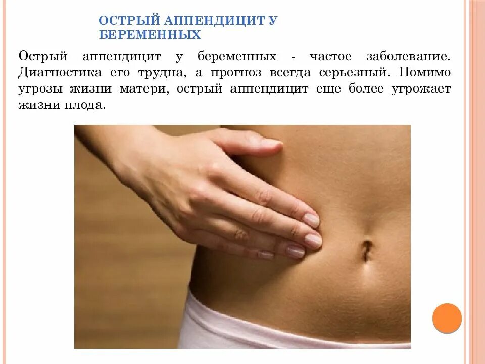 Аппендицит рекомендации. Аппендицит у беременной. диагностика острого аппендицита у беременных. расположение аппендицита у беременных. аппендицит беременности аппендицит.