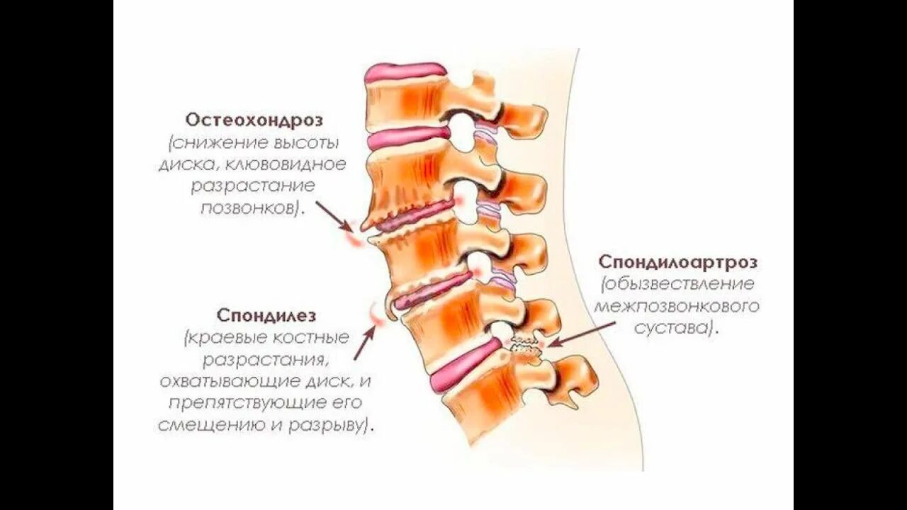 Снижена высота сегментов
