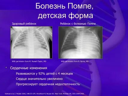 Болезне ый вид