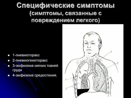Грудная эмфизема
