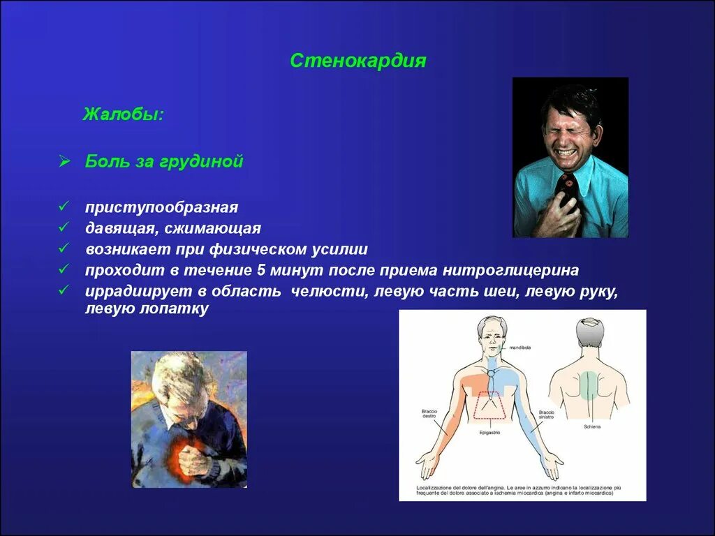 Стенокардия жалобы. Жалобы при стенокардии. Жалобы пациента при стенокардии. Стенокардия жалобы больно.