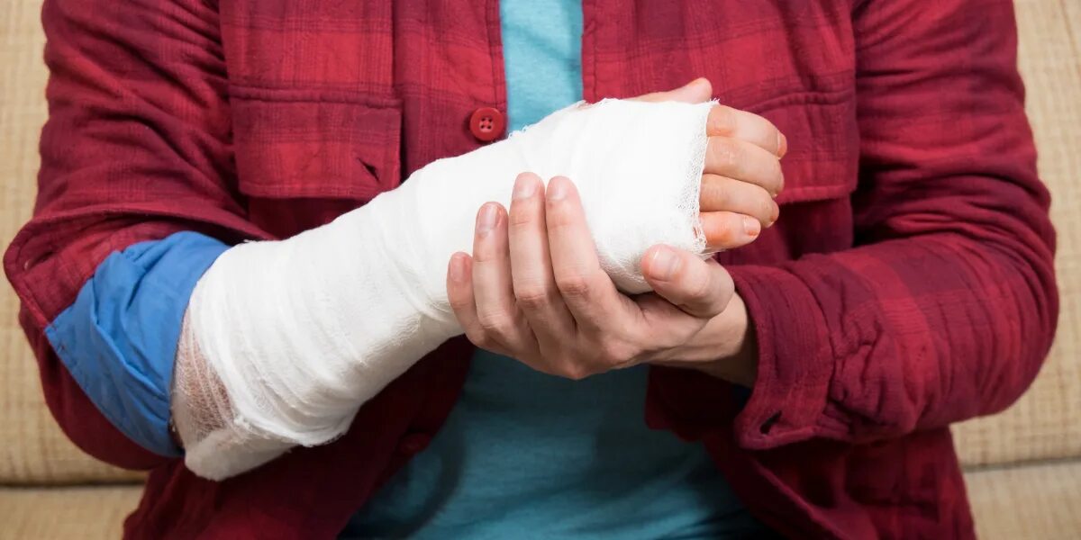 Перелом руки мобилизация. Как люди ломают руку. Раскрытие ладони. Сломать руку без боли в домашних. Анекдот про сломанную руку.