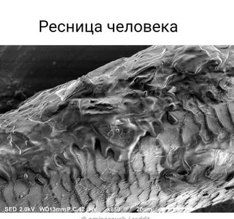 Реснички под микроскопом