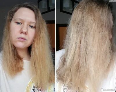 Волосы стали быстрее жирниться