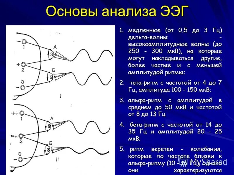 О чем говорит ээг. Амплитуда волн ЭЭГ. Амплитуда сигнала ЭЭГ. Физические основы электроэнцефалографии. Ритмы ЭЭГ частота и амплитуда.