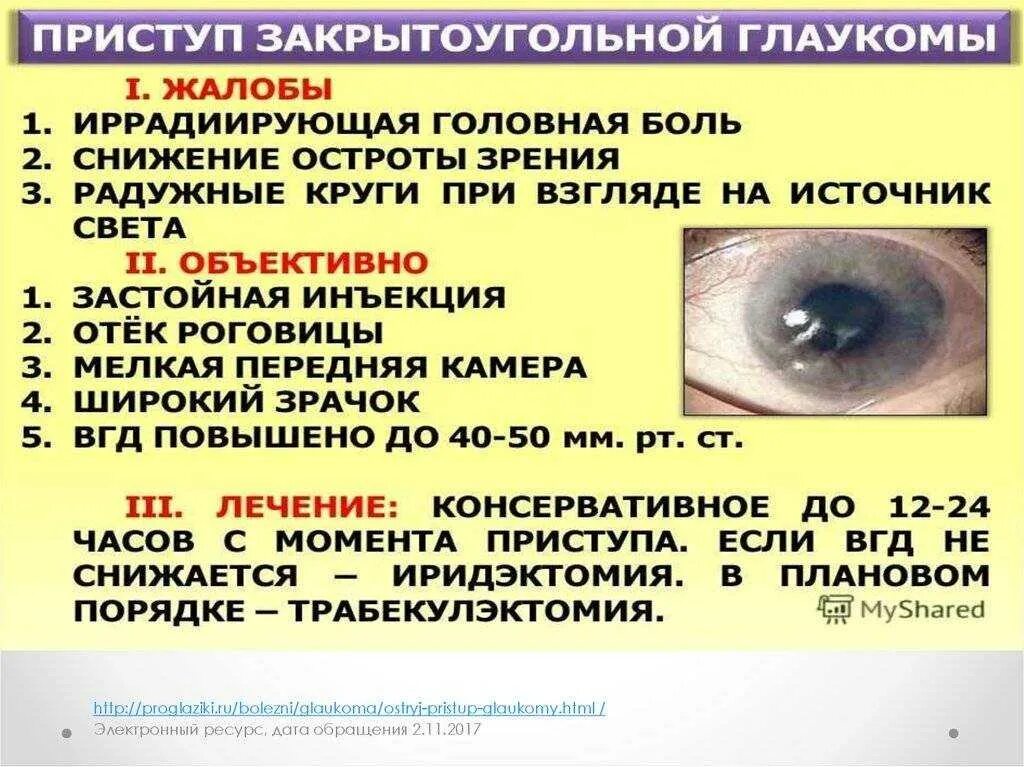 Закрытоугольная глаукома симптомы. Открытоугольная глаукома клиника. Симптомы острого приступа закрытоугольной глаукомы. Симптомы открытоугольной глаукомы.