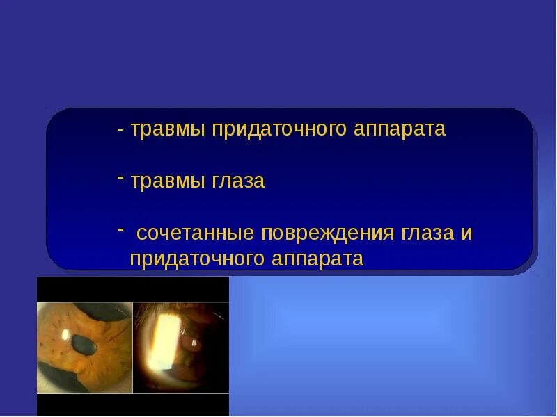 Как лечить травму глаза. Травмы придаточного аппарата глаза. сочетанная травма глаза.