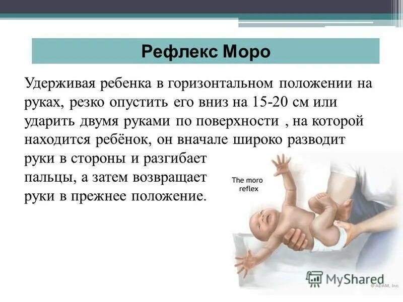 Рефлекс Моро у грудничка в 2 месяца. Рефлексы новорожденного маро. Рефлекс Моро у грудничка в 3 месяца.