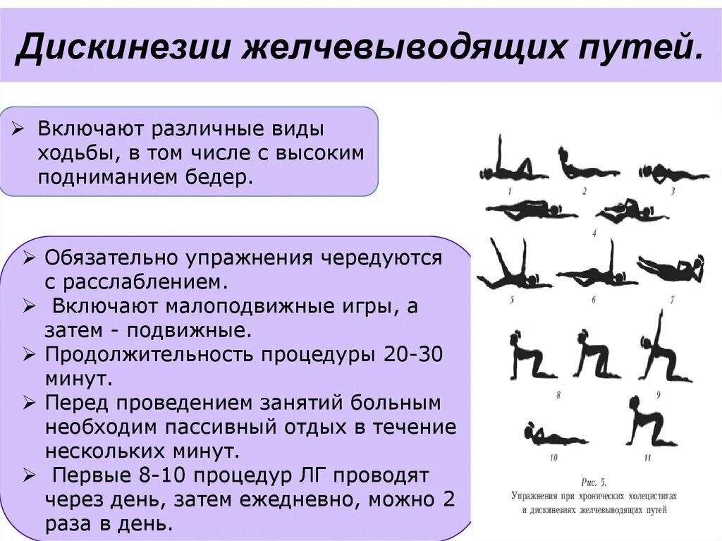 Гимнастика для желчного пузыря при дискинезии. ЛФК при дискинезии желчевыводящих. Диетотерапия при дискинезии желчевыводящих путей. Диета при дискинезии желчевыводящих путей у детей. Упражнения при холецистите