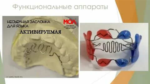 Упор для языка