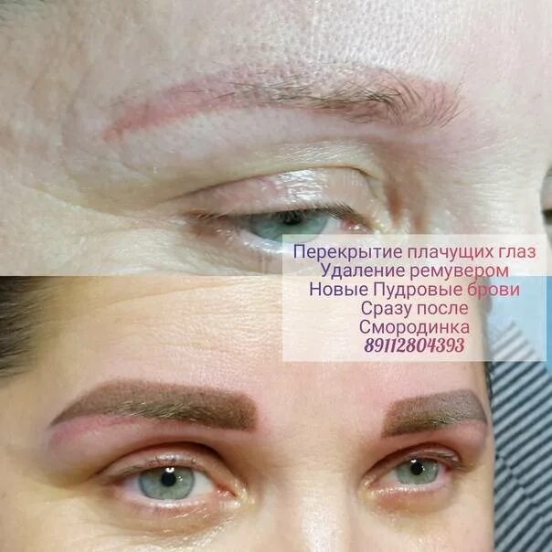 Ремувер для пм. Татуаж бровей. Как удалять ремувером. Как удалять ремувером. Татуаж бровей.
