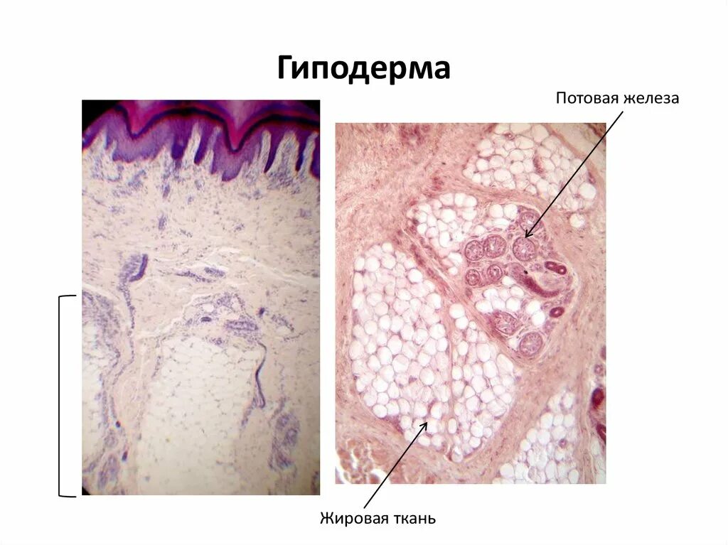 Строение гиподермы