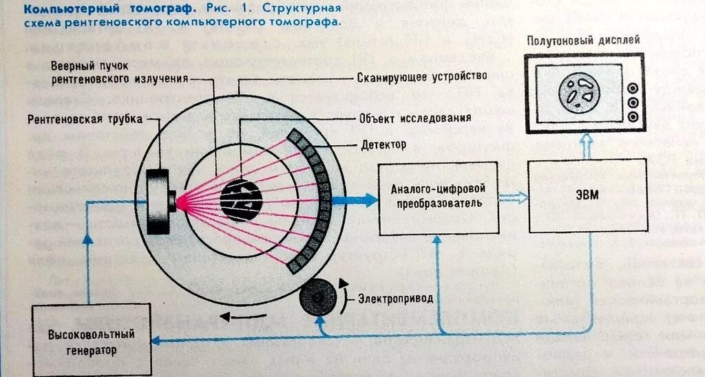 Работа компьютерного томографа. Схема рентгеновского компьютерного томографа. схема строения компьютерного томографа. принципиальная схема магнитно резонансного томографа. структурная схема рентгеновского компьютерного томографа.