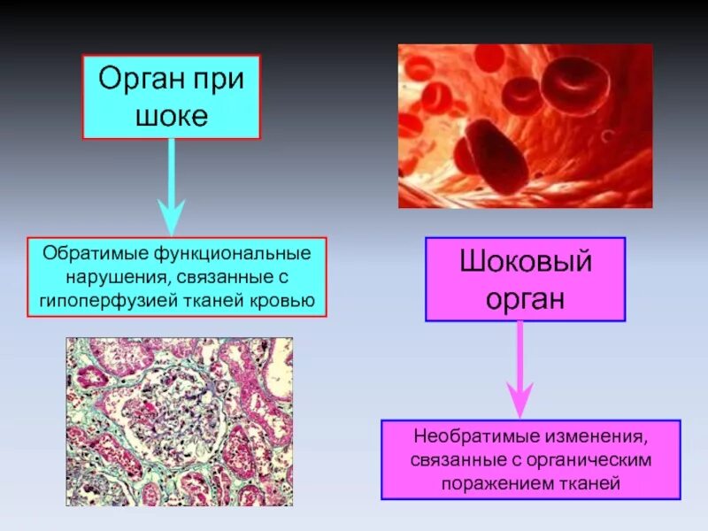 Необратимые изменения. Изменения в органах при шоке.