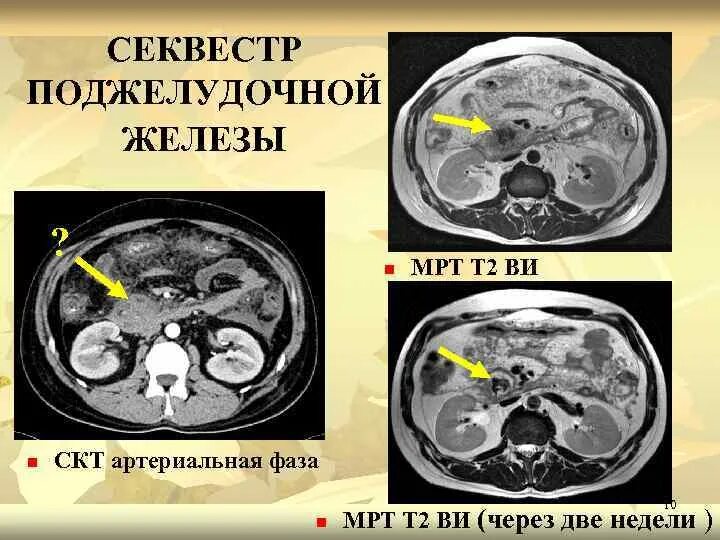 Рецепт кт