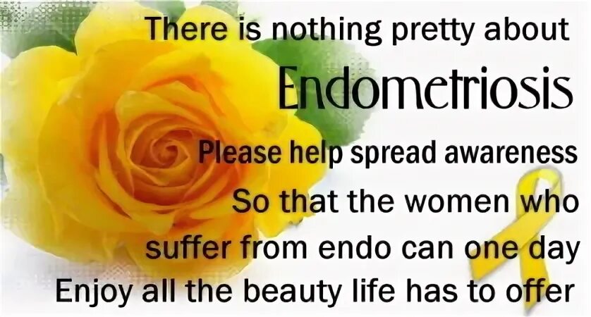 Cage the elephant tell me i'm pretty кто на обложке. Барбара палвин. Pretty nothings. Cage the elephant фото. Pretty dope.