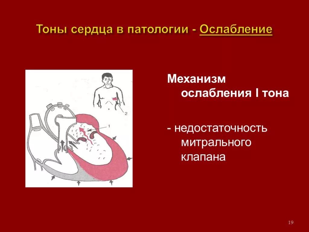 Ослабленные тоны сердца. Тоны сердца патология. Механизм ослабления 1 тона сердца. Тоны сердца происхождение методы исследования. Механизм образования i тона сердца..