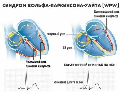 Признаки феноменов