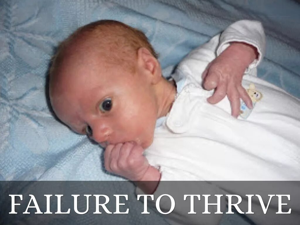 Failure to receive. Failure to thrive. to thrive.