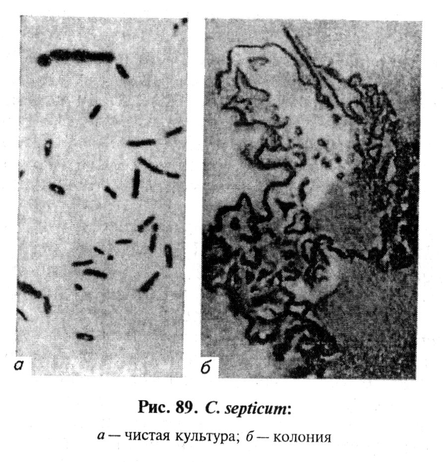 Клостридии перфрингенс микробиология. Клостридии перфрингенс (clostridium perfringens). Клостридии злокачественного отека. Злокачественный отёк у крс. Возбудитель злокачественного отека.