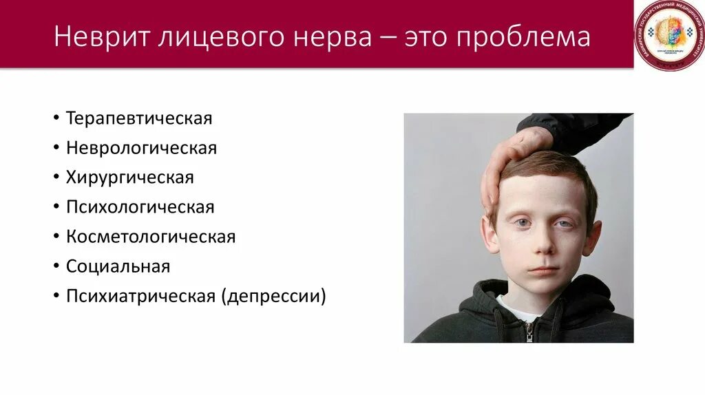 Неврит лицевого нерва. Неврит лицевого нерва у детей. Воспаление тройничного лицевого нерва. Неврит у ребенка симптомы. Неврит лицевого нерва отзывы