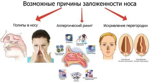 Не дышит одна ноздря как