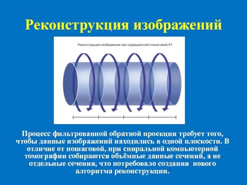 Реконструкция кт изображений. Фильтрованная Обратная проекция. Многослойная кт. Реконструкция и воспроизведение изображения кт. Кт реконструкция