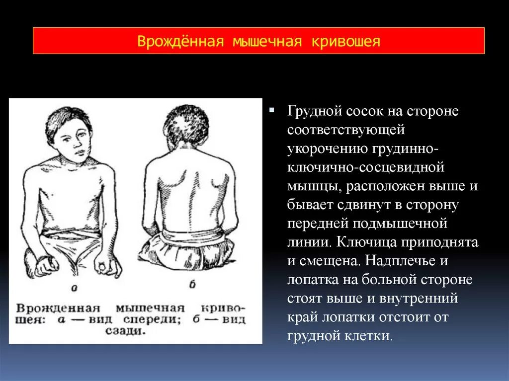 Укорочение трубчатых