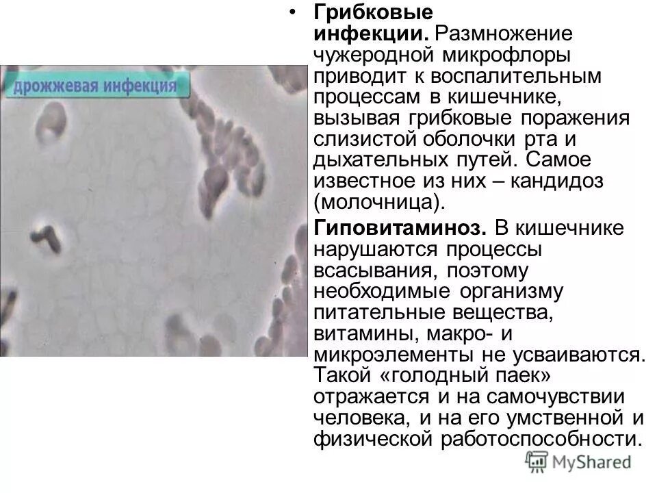 Грибковые заболевания внутренних органов. Аспергиллез слизистых. Аллергический бронхолегочный аспергиллез. Грибковая инфекция дыхательных путей. Грибковая пневмония снимки.