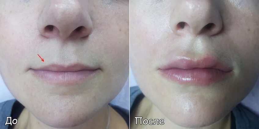 губы крыло чайки