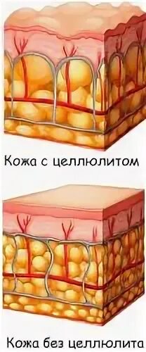 Почему у женщин есть целлюлит