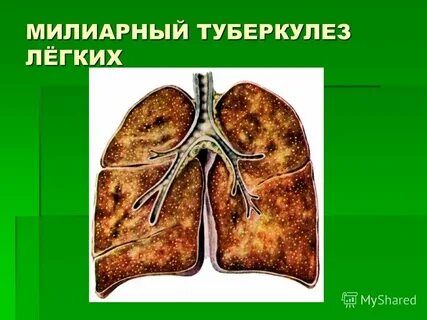 Туберкулезно легочное отделение