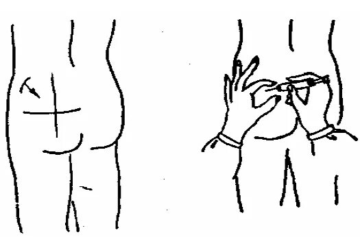 Куда делать внутримышечный укол. Укол в бедро внутримышечно схема. Внутримышечная инъекция в ягодицу себе. Схема как делать уколы внутримышечно.