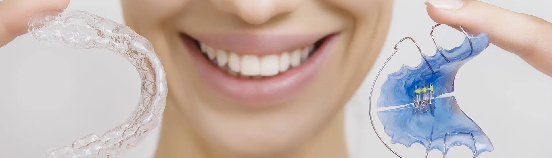 Ортодонтия. Выравнивание зубов коронками. Квесты нужные для каппы