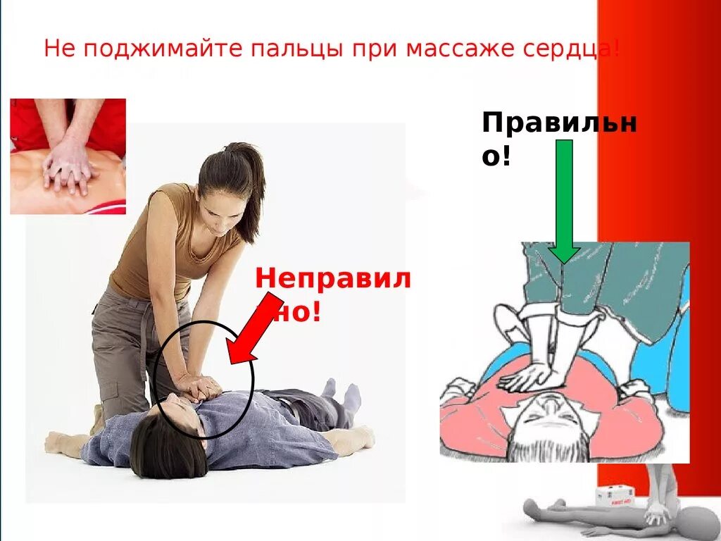 Ошибки при проведении сердечно легочной. Ошибки сердечно легочной реанимации. ошибки при проведении слр. ошибки при сердечно-легочной реанимации. правильное положение рук при сердечно легочной реанимации.