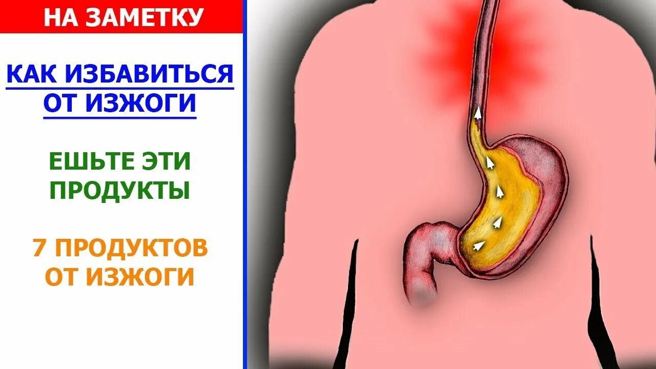 Сильная изжога как избавиться. Изжога как избавиться. Народные средства при изжоге. Как избавиться от изжоги.